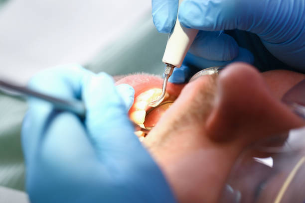 Best Emergency Dentist for Lost Fillings or Crowns in Stanfield, NC
