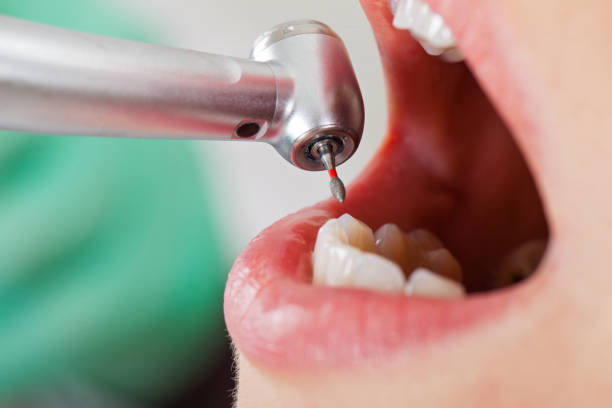 Best Urgent Dental Care for Toothache in Stanfield, NC
